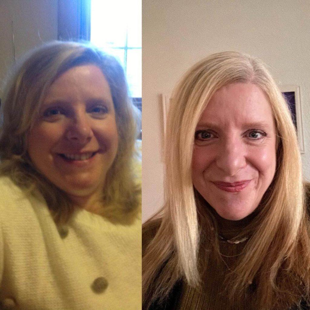 A side-by-side photo of Rebecca. On the left, she smiles into the camera before her weight loss. On the right she smiles into the camera after, with a noticeable difference in the fullness of her face.