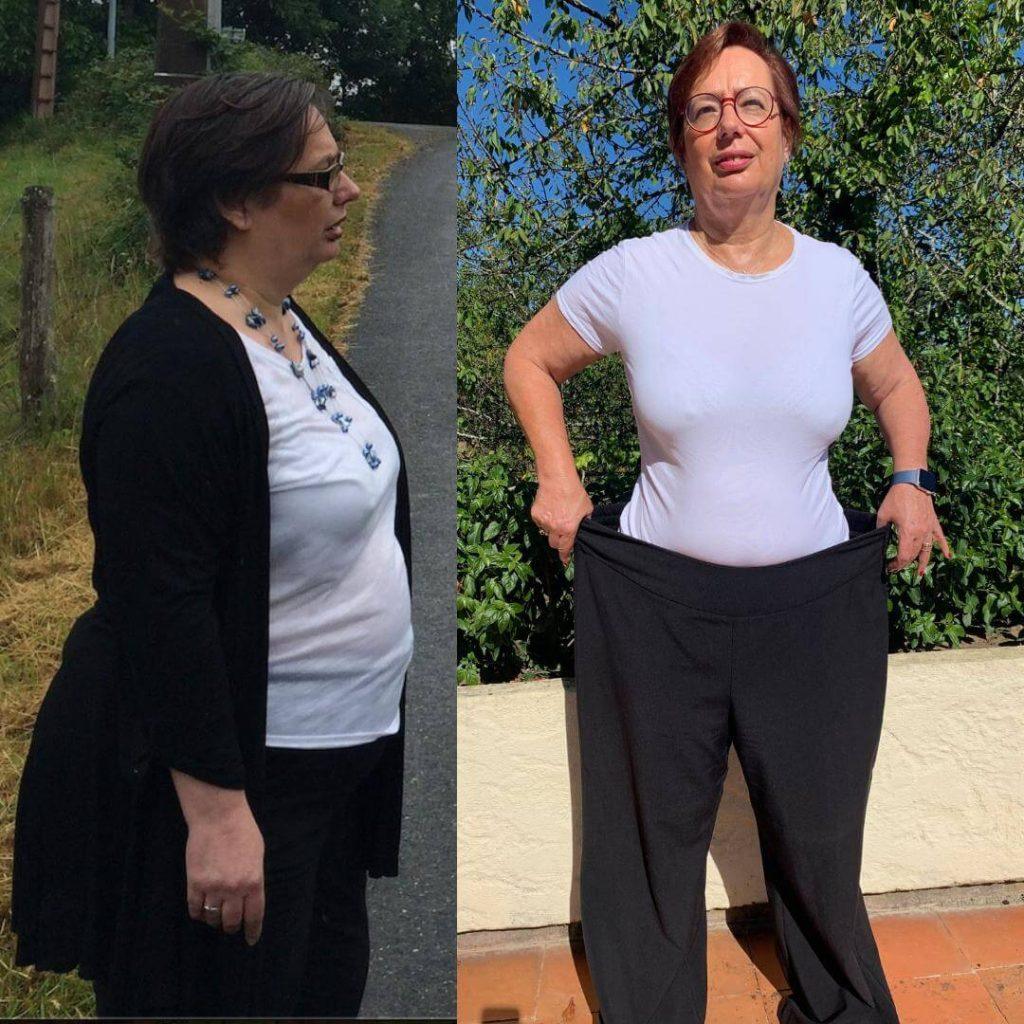 A side-by-side transformation photo of Sally. One the left she is outdoors, wearing a white top and black cardigan, with a fuller figure. On the right, she is holding out a pair of much larger trousers having lost 4 stone and successfully reversed prediabetes.