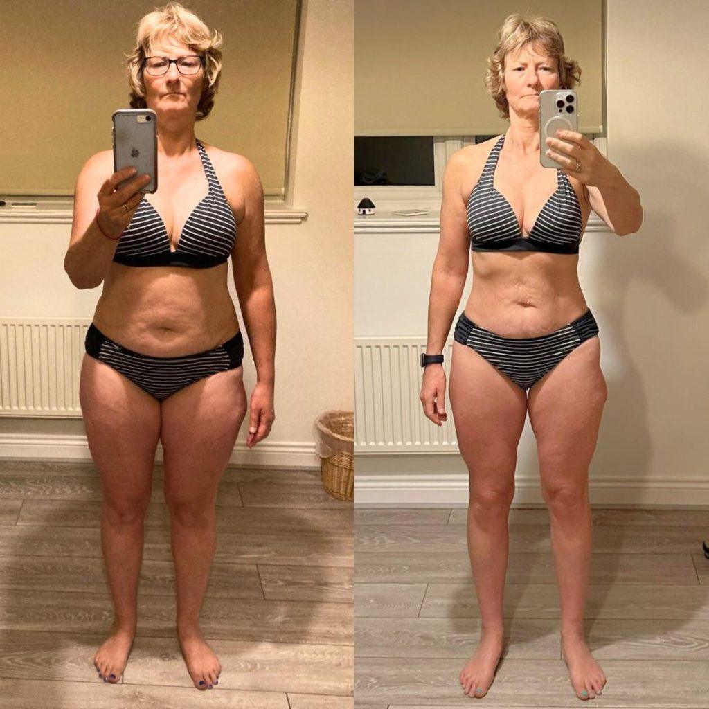 A side-by-side image of Helen, a Trinity client, before and after her weight loss.